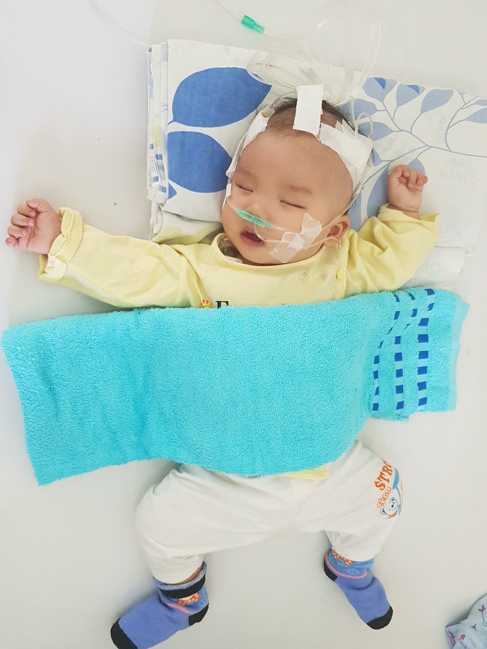 Bé trai 4 tháng tuổi bị dị tật không lá lách, tim bẩm sinh đã về với mây trời - 2 Bé trai 4 tháng tuổi bị dị tật không lá lách, tim bẩm sinh đã về với mây trời - 2