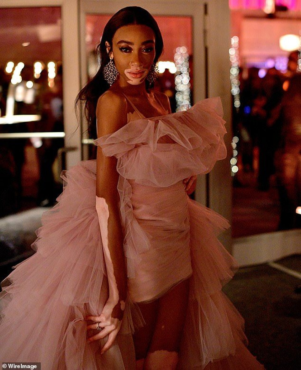 Siêu mẫu bạch biến diện váy sành điệu dự tiệc Oscar  - 6