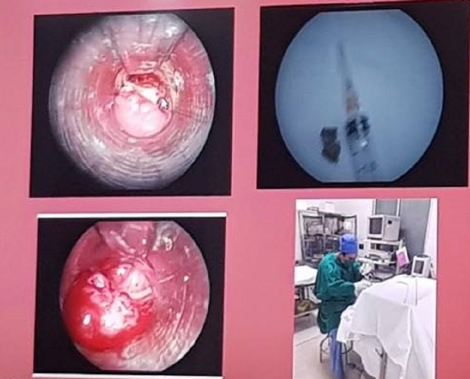 xuong vit.jpg xuong vit.jpg