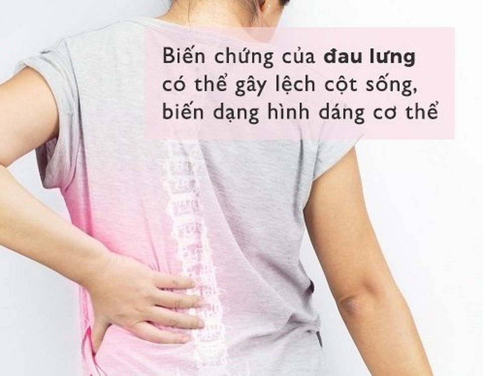 Bị đau lưng lan xuống mông là do đâu? - 3 Bị đau lưng lan xuống mông là do đâu? - 3