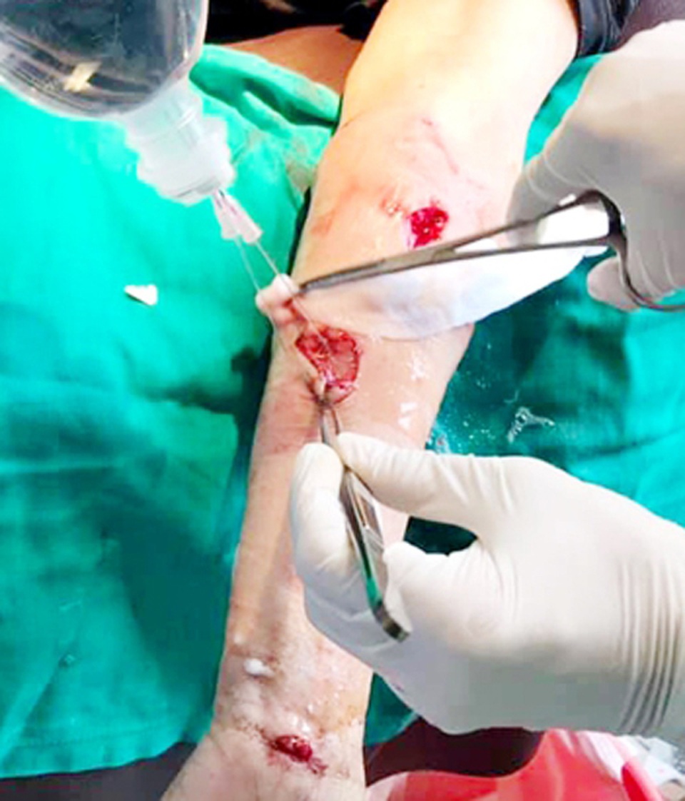 Sang nhà hàng xóm chơi, cụ bà 79 tuổi bị cặp chó béc-giê tấn công với hàng chục vết thương - 1 Sang nhà hàng xóm chơi, cụ bà 79 tuổi bị cặp chó béc-giê tấn công với hàng chục vết thương - 1