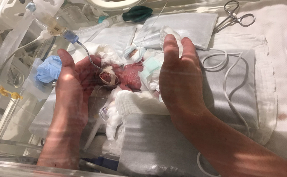 Sức sống kì diệu của cậu bé nhỏ nhất thế giới - 2 Sức sống kì diệu của cậu bé nhỏ nhất thế giới - 2