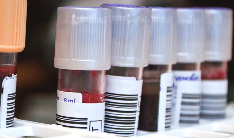 Bệnh nhân thứ hai trong lịch sử nhiễm virus HIV đã được chữa khỏi - 2 Bệnh nhân thứ hai trong lịch sử nhiễm virus HIV đã được chữa khỏi - 2