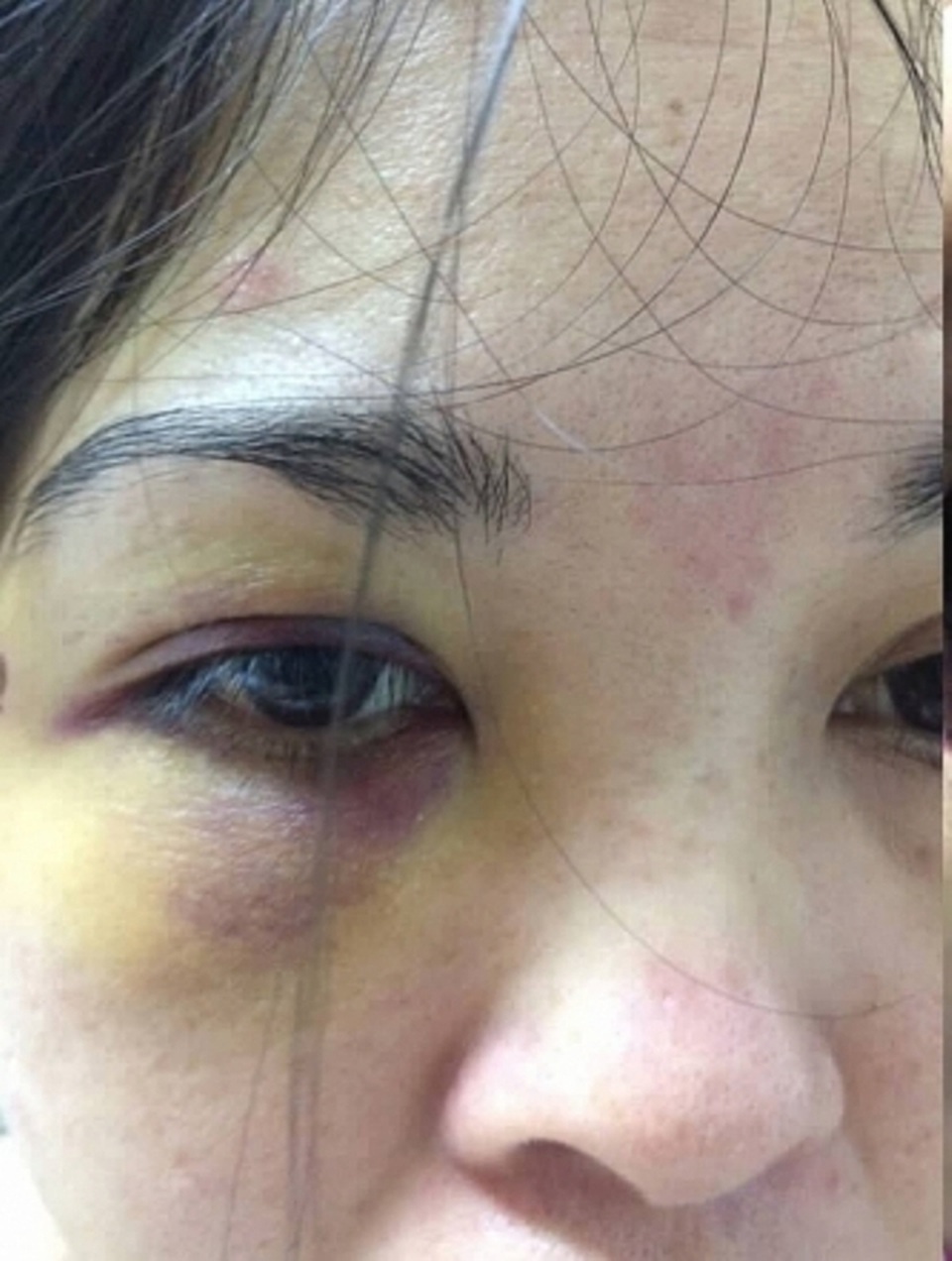 Lùm xùm vụ chuyên viên Sở GD-ĐT bị tố hành hung gây thương tích cho bạn gái - 1