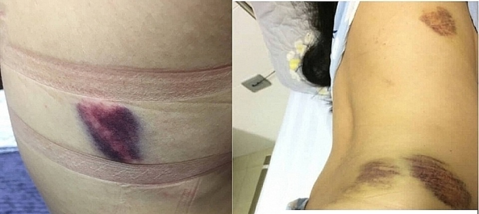 Lùm xùm vụ chuyên viên Sở GD-ĐT bị tố hành hung gây thương tích cho bạn gái - 2