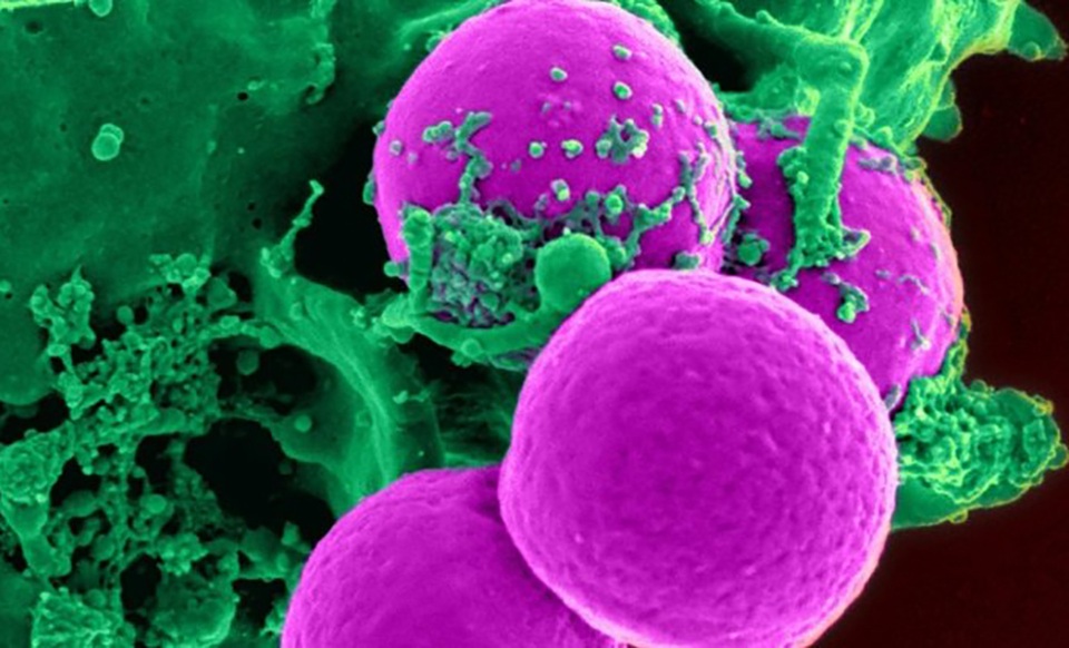 Tìm ra phương pháp mới điều trị các bệnh tự miễn - 1 Tìm ra phương pháp mới điều trị các bệnh tự miễn - 1