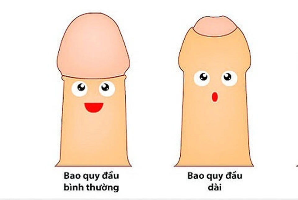 Bao quy đầu dài có nguy hiểm không? - 1 Bao quy đầu dài có nguy hiểm không? - 1