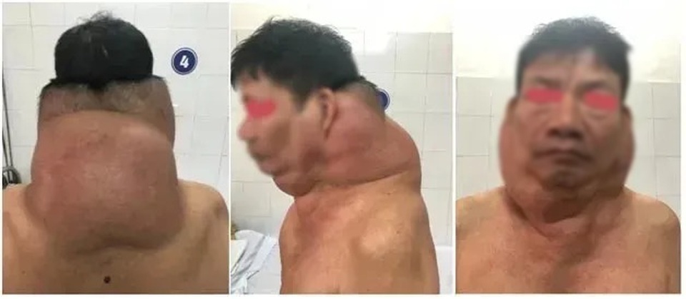nguoigau1.jpg nguoigau1.jpg
