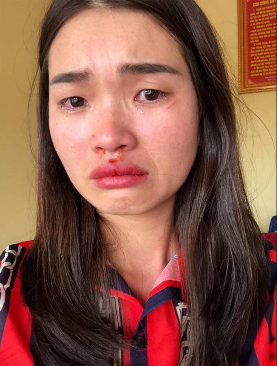 Chủ “nhà xe đầu gấu” đánh nữ hành khách ra trình diện công an - 1 Chủ “nhà xe đầu gấu” đánh nữ hành khách ra trình diện công an - 1