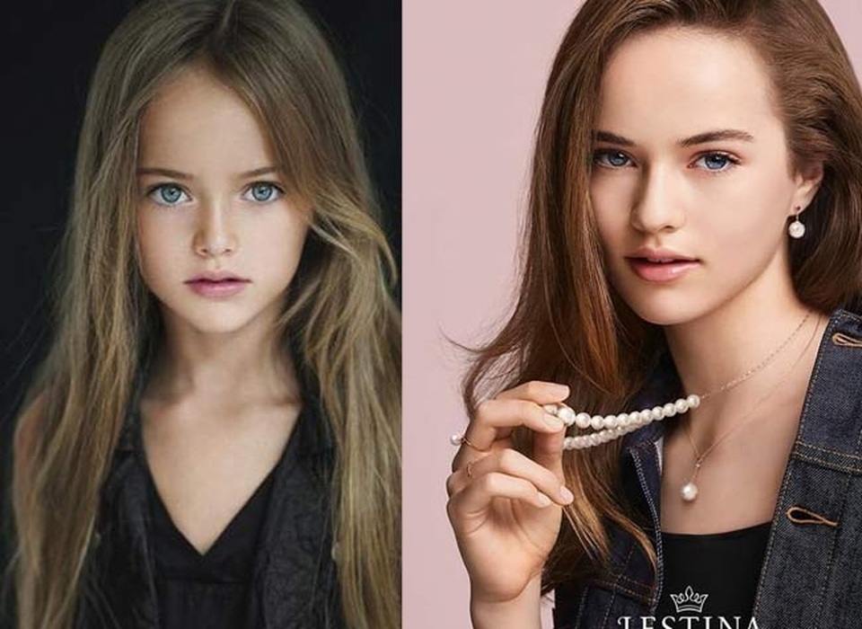 Bất ngờ với nhan sắc hiện tại của bé gái đẹp nhất thế giới - 5 Bất ngờ với nhan sắc hiện tại của bé gái đẹp nhất thế giới - 5