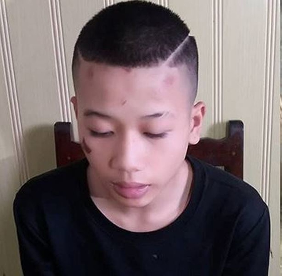 Khởi tố thiếu niên 17 tuổi đâm chết “tình địch” vì ghen - 1