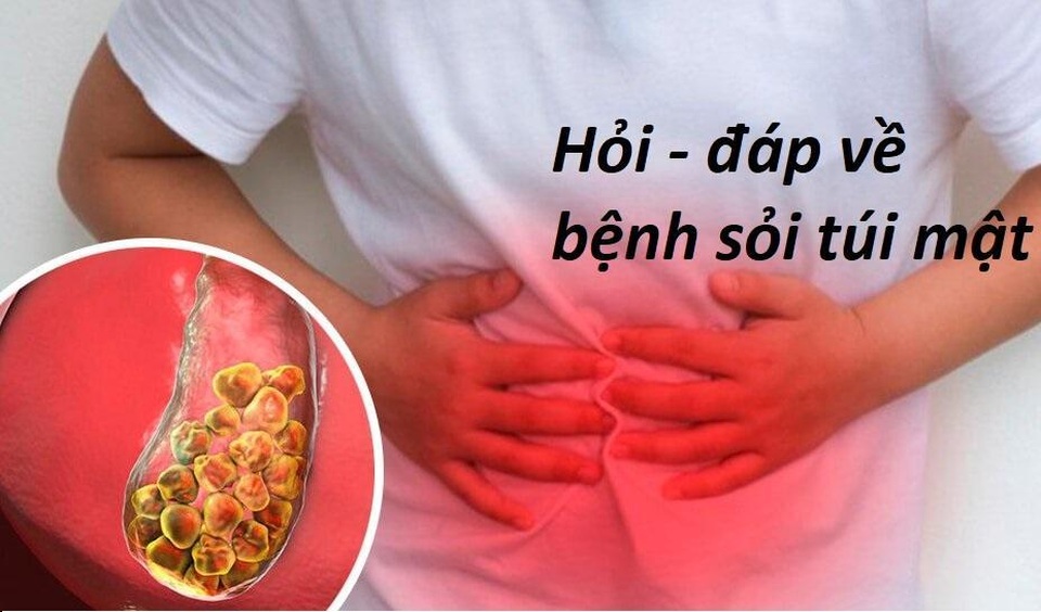Giải đáp những câu hỏi thường gặp về bệnh sỏi túi mật - 1 Giải đáp những câu hỏi thường gặp về bệnh sỏi túi mật - 1