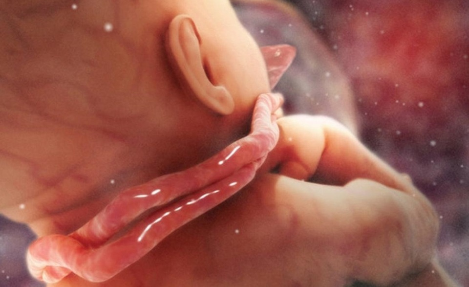 Bác sĩ Quốc tế tháo 4 vòng “tràng hoa” quấn cổ cho bé “nhanh như chớp” - 1