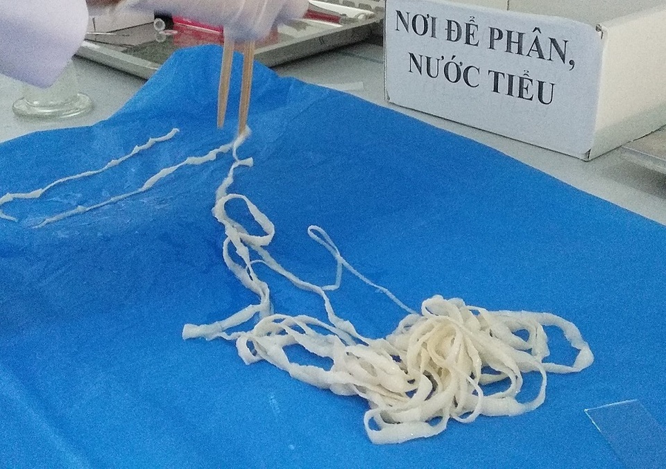 Xét nghiệm dương tính: Chưa thể khẳng định cơ thể có sán! - 3 Xét nghiệm dương tính: Chưa thể khẳng định cơ thể có sán! - 3