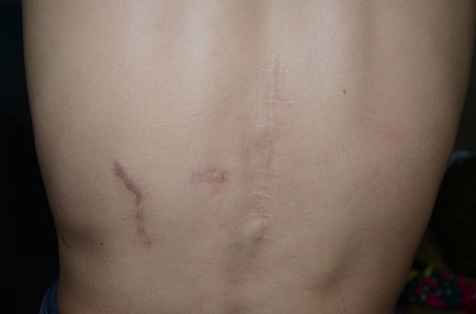 Mong manh tính mạng người phụ nữ dân tộc Nùng mắc cùng lúc nhiều thứ bệnh - 5