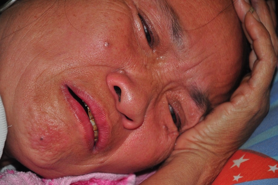 Mẹ nằm liệt giường khóc nghẹn thương con bị ung thư hạch không tiền đi viện - 1 Mẹ nằm liệt giường khóc nghẹn thương con bị ung thư hạch không tiền đi viện - 1