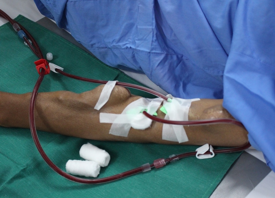 Mẹ bị suy thận nặng vẫn khó nhọc đi bán vé số cầm cự nuôi con ăn học - 3 Mẹ bị suy thận nặng vẫn khó nhọc đi bán vé số cầm cự nuôi con ăn học - 3
