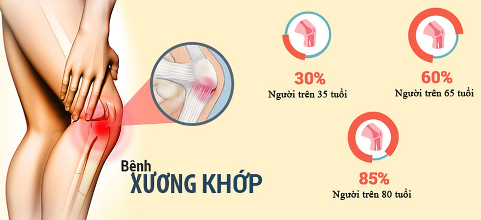Dinh dưỡng bảo vệ xương và sụn khớp chuẩn Hoa Kỳ - 1