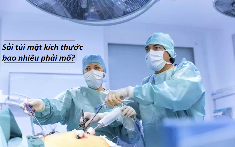 Sỏi túi mật kích thước bao nhiêu phải mổ? - 1 Sỏi túi mật kích thước bao nhiêu phải mổ? - 1