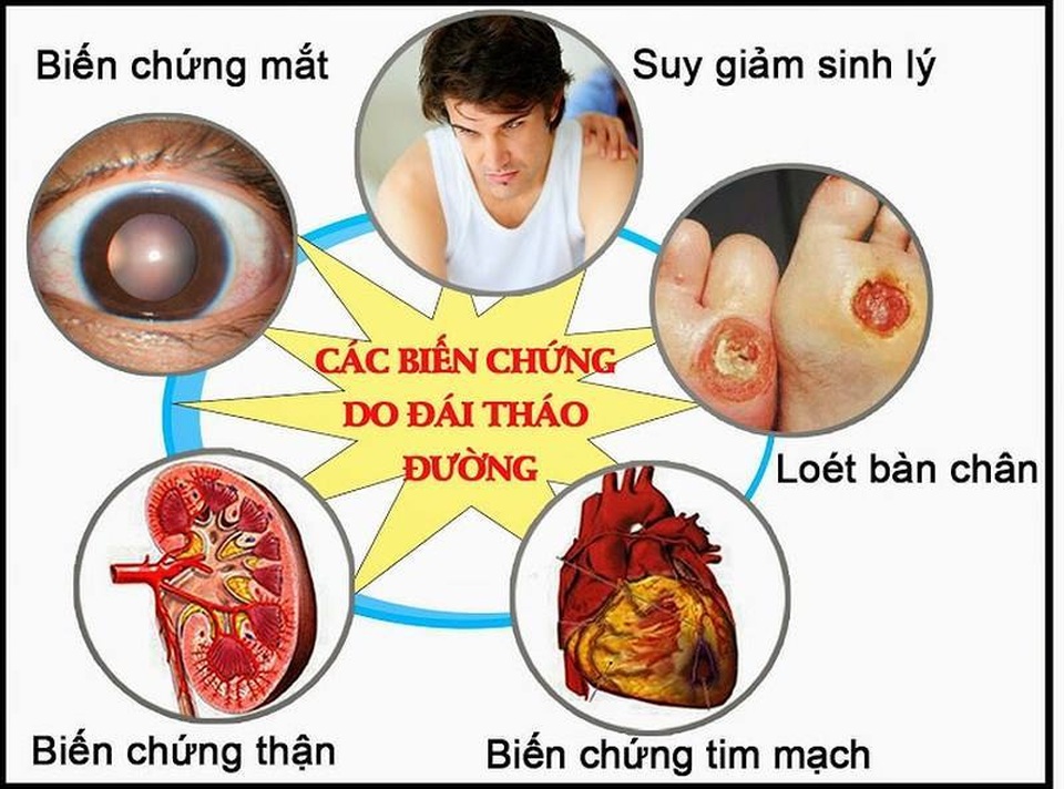 Thực phẩm bảo vệ sức khỏe Glugaz - Giúp xua tan nỗi lo về biến chứng bệnh tiểu đường - 2