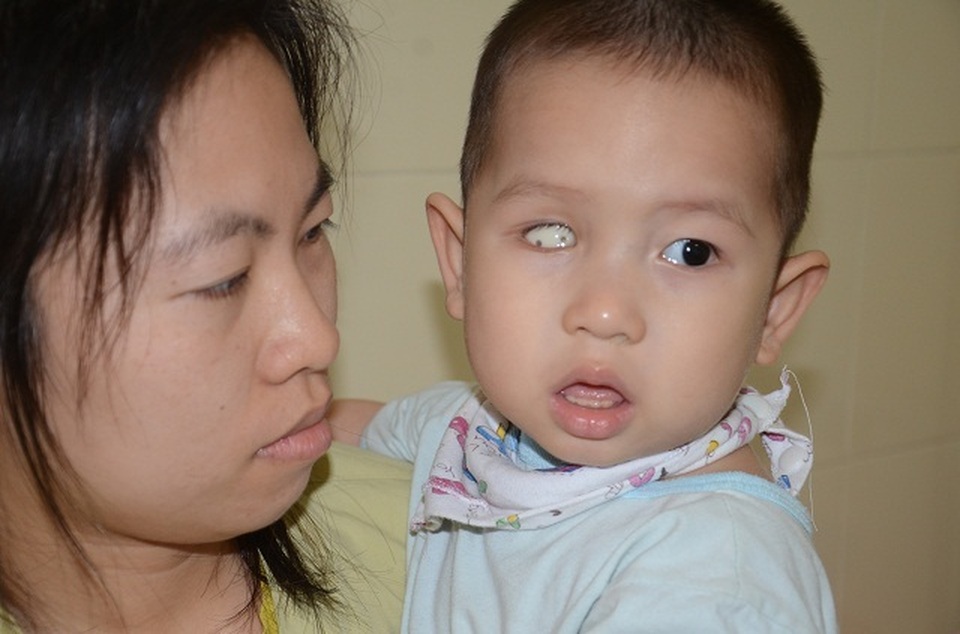 Tiếng khóc xé lòng của bé trai 16 tháng tuổi mắc ung thư võng mạc - 3 Tiếng khóc xé lòng của bé trai 16 tháng tuổi mắc ung thư võng mạc - 3