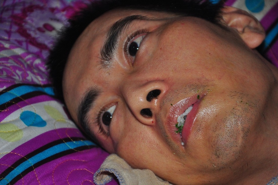 Bị xe gây tai nạn và bỏ trốn, người đàn ông sống cảnh thực vật - 6 Bị xe gây tai nạn và bỏ trốn, người đàn ông sống cảnh thực vật - 6