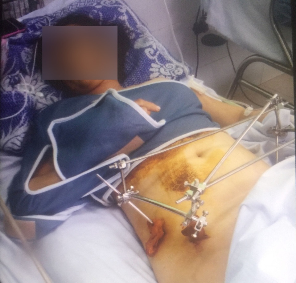 Hai tuần nỗ lực truy tìm tài xế gây tai nạn nghiêm trọng rồi bỏ trốn - 1 Hai tuần nỗ lực truy tìm tài xế gây tai nạn nghiêm trọng rồi bỏ trốn - 1