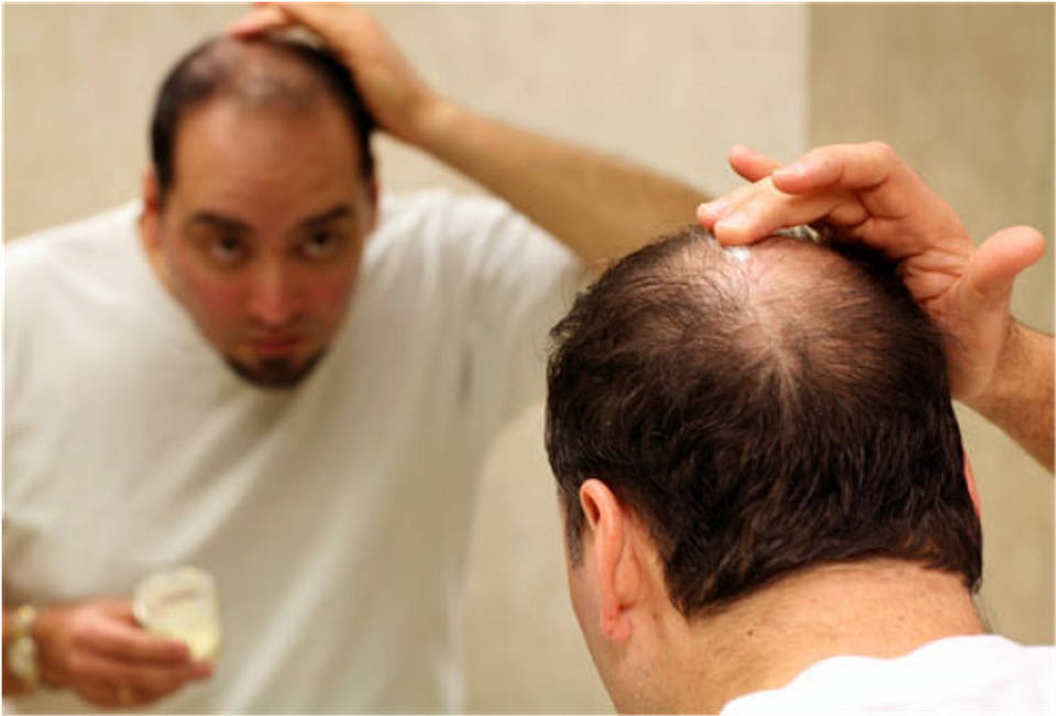 Kích thích sự phát triển của nang tóc - 1 Kích thích sự phát triển của nang tóc - 1