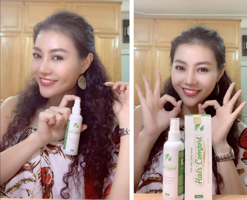 Kích thích sự phát triển của nang tóc - 3 Kích thích sự phát triển của nang tóc - 3