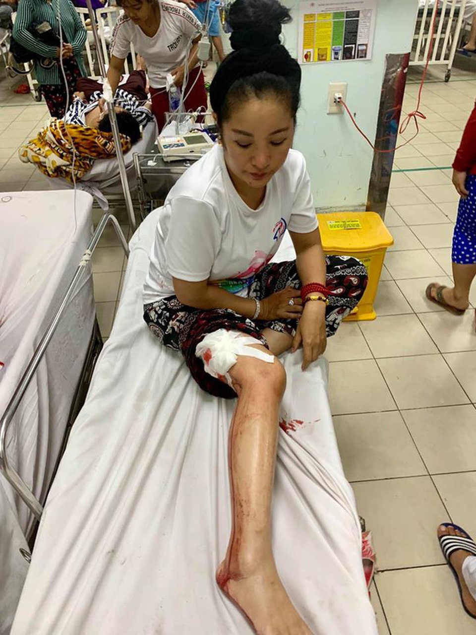 Danh hài Thúy Nga gặp tai nạn phải khâu gần 10 mũi - 1 Danh hài Thúy Nga gặp tai nạn phải khâu gần 10 mũi - 1