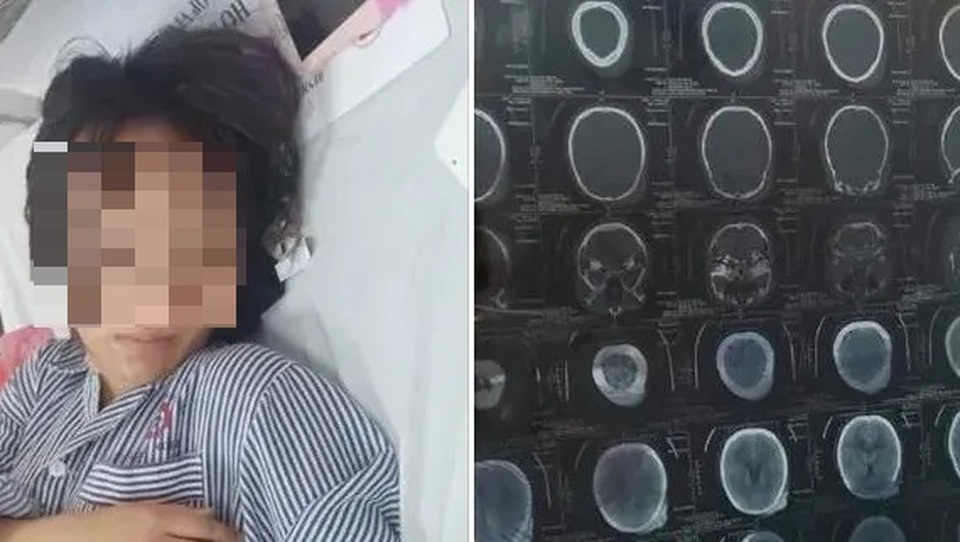Quảng Ninh: Xác minh vụ nữ sinh bị đánh hội đồng đến tụ máu đầu - 1 Quảng Ninh: Xác minh vụ nữ sinh bị đánh hội đồng đến tụ máu đầu - 1