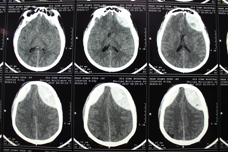 Con bị tai nạn, mẹ khóc lặng vì không có tiền đóng viện phí cứu con - 2