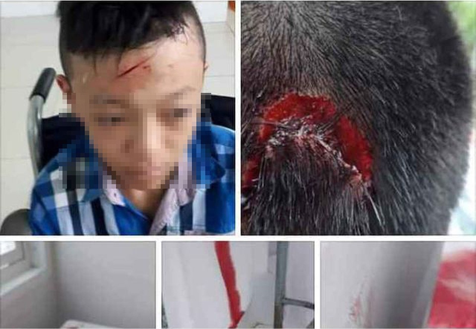 Vĩnh Long: Xác minh thông tin nhà trường bỏ mặc học sinh bị bạn đánh chảy máu - 2 Vĩnh Long: Xác minh thông tin nhà trường bỏ mặc học sinh bị bạn đánh chảy máu - 2