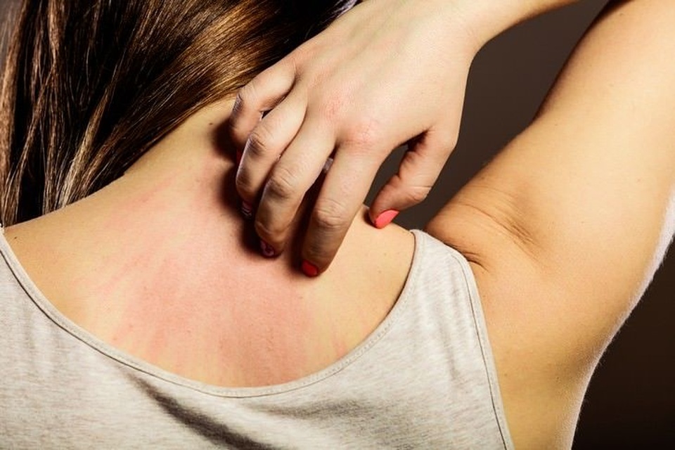 Những lợi ích và tác hại của sữa bò - 5 Những lợi ích và tác hại của sữa bò - 5