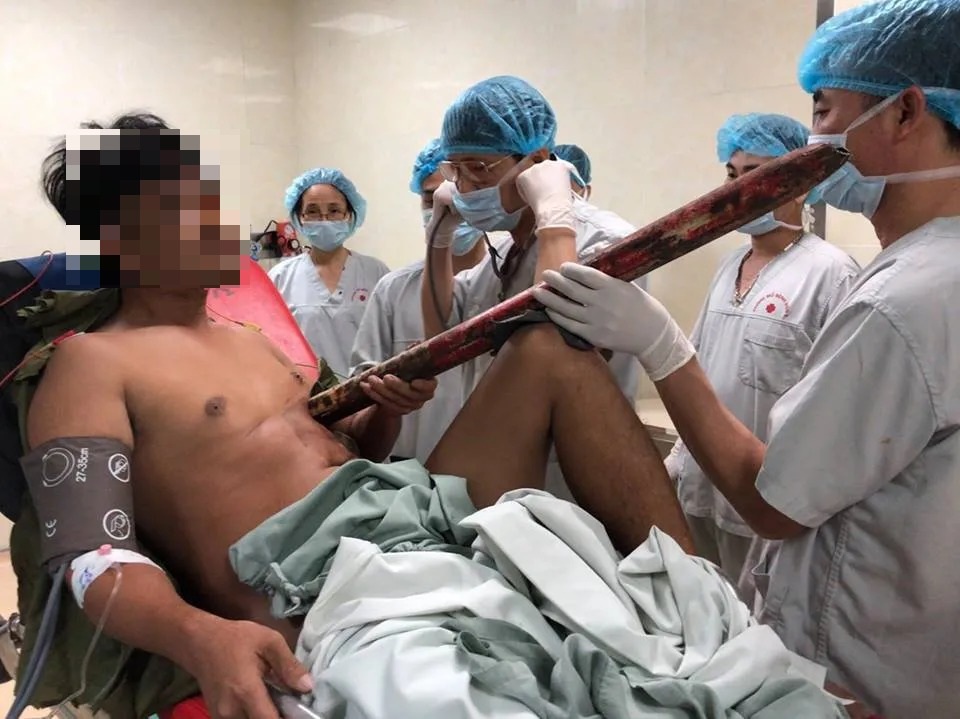 Rùng mình nam thanh niên bị cột sắt đâm thấu ngực do tai nạn giao thông - 1