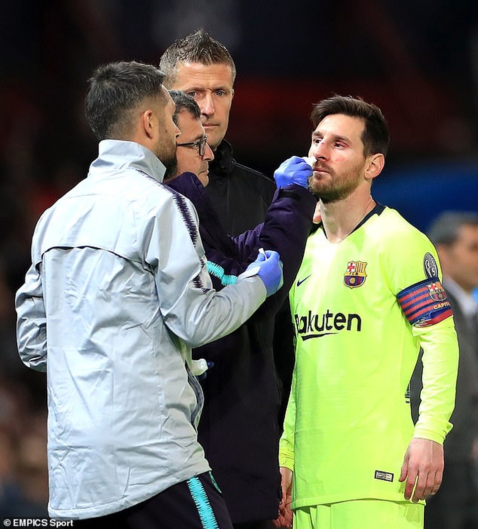 Messi chảy máu đầm đìa sau khi dính “đòn” của Smalling - 7 Messi chảy máu đầm đìa sau khi dính “đòn” của Smalling - 7
