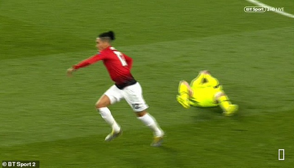Messi chảy máu đầm đìa sau khi dính “đòn” của Smalling - 4 Messi chảy máu đầm đìa sau khi dính “đòn” của Smalling - 4