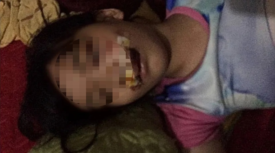 Một nữ lao công bị chó cắn trọng thương - 2