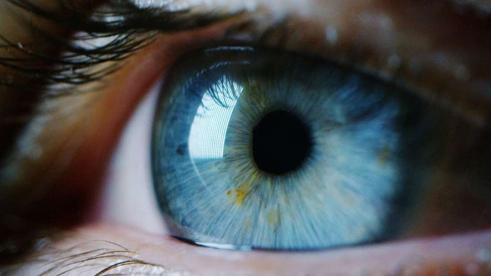 Người phụ nữ khốn khổ vì có… bốn con ong sống trong mắt - 1 Người phụ nữ khốn khổ vì có… bốn con ong sống trong mắt - 1