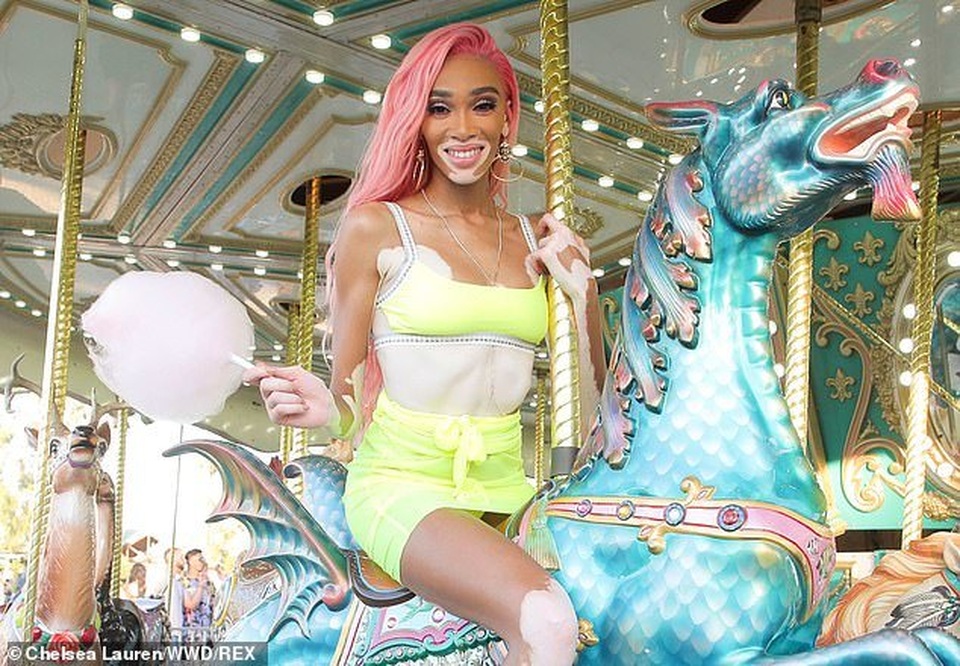 Siêu mẫu bạch biến bốc lửa với váy vàng chanh - 6 Siêu mẫu bạch biến bốc lửa với váy vàng chanh - 6