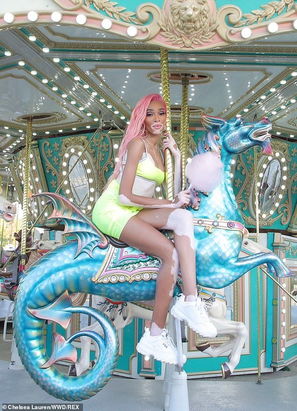 Siêu mẫu bạch biến bốc lửa với váy vàng chanh - 2 Siêu mẫu bạch biến bốc lửa với váy vàng chanh - 2