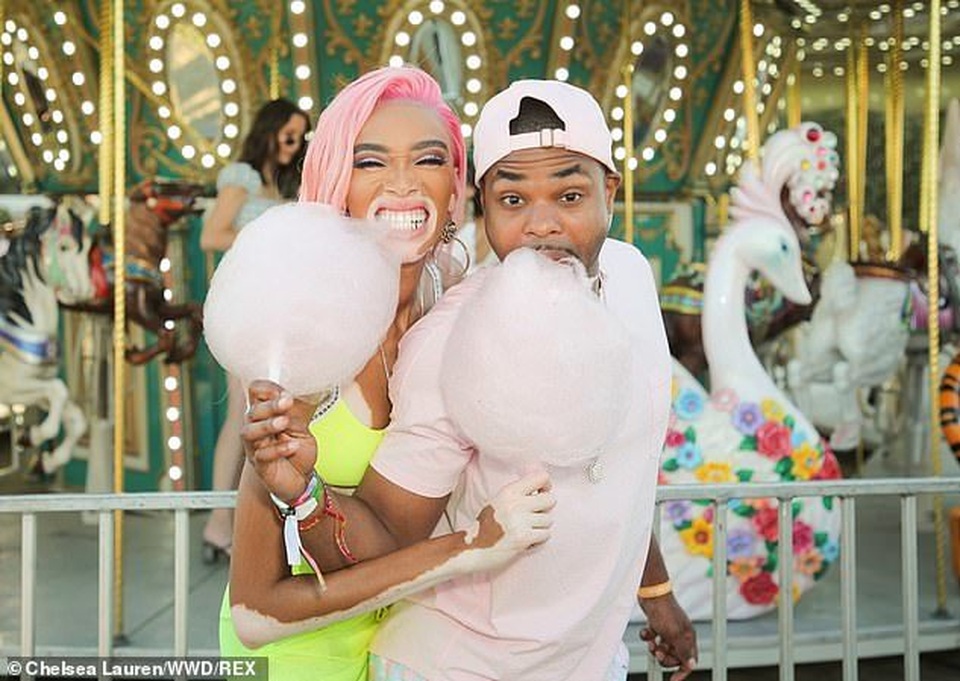 Siêu mẫu bạch biến bốc lửa với váy vàng chanh - 9 Siêu mẫu bạch biến bốc lửa với váy vàng chanh - 9