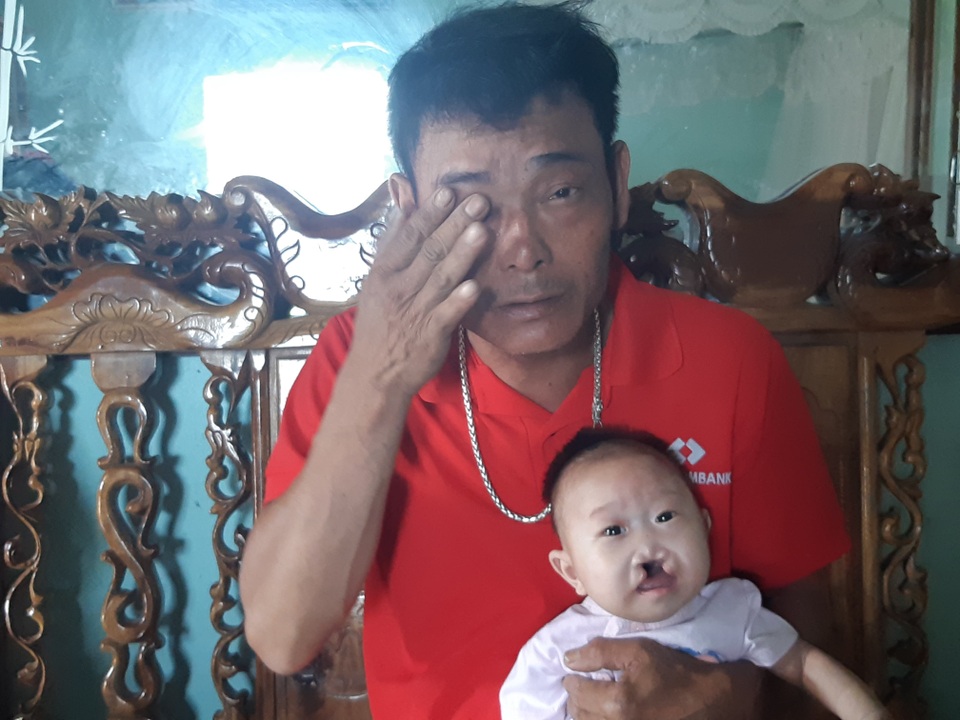 Mong manh số phận bé 4 tháng tuổi bị tim bẩm sinh, hở hàm ếch đợi một phép màu! - 3 Mong manh số phận bé 4 tháng tuổi bị tim bẩm sinh, hở hàm ếch đợi một phép màu! - 3