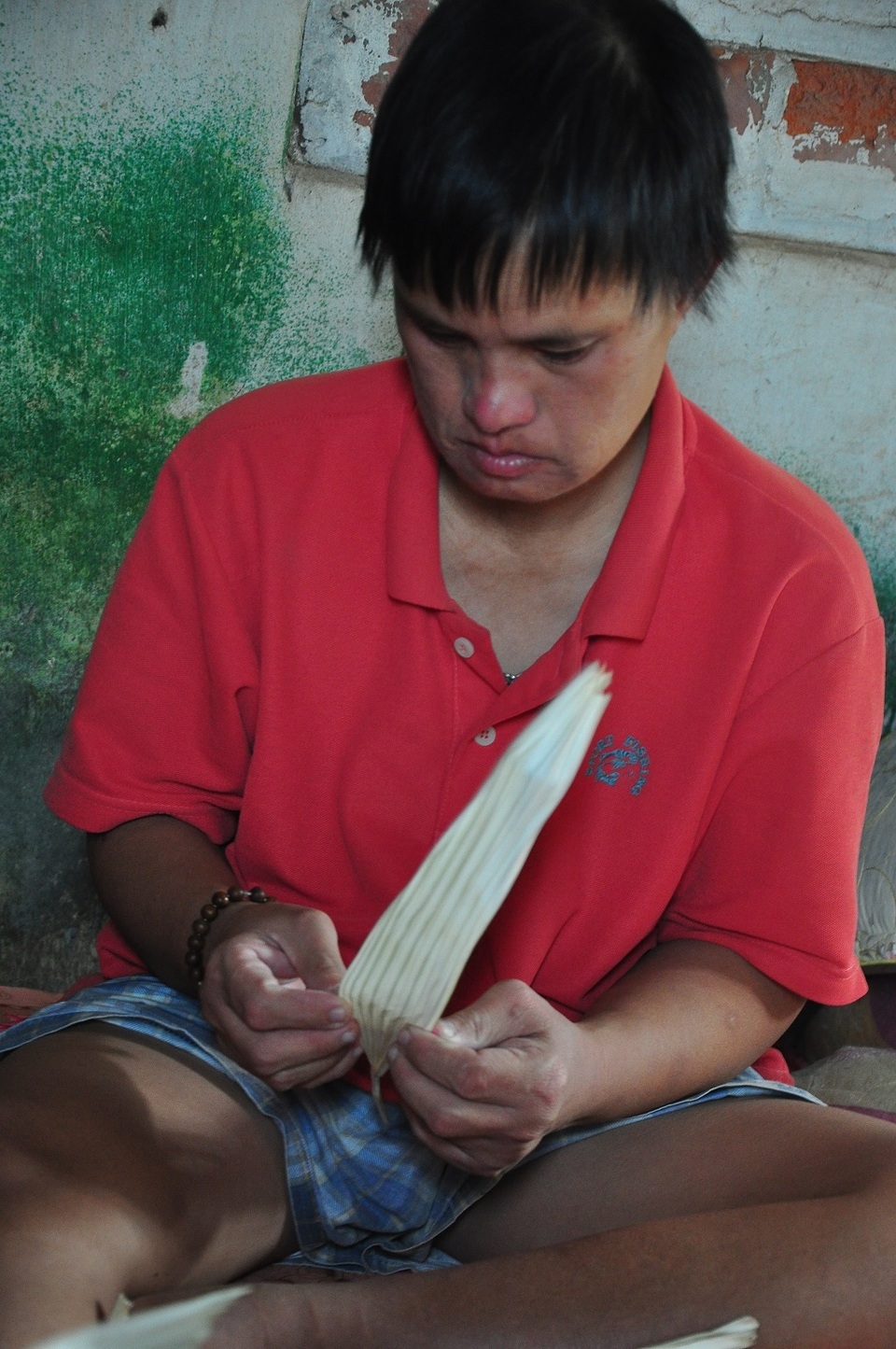 Người phụ nữ mang khuôn mặt lạ cả đời cóp nhặt chờ ngày chữa bệnh hiểm cho em! - 8