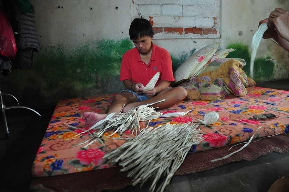 Người phụ nữ mang khuôn mặt lạ cả đời cóp nhặt chờ ngày chữa bệnh hiểm cho em! - 4