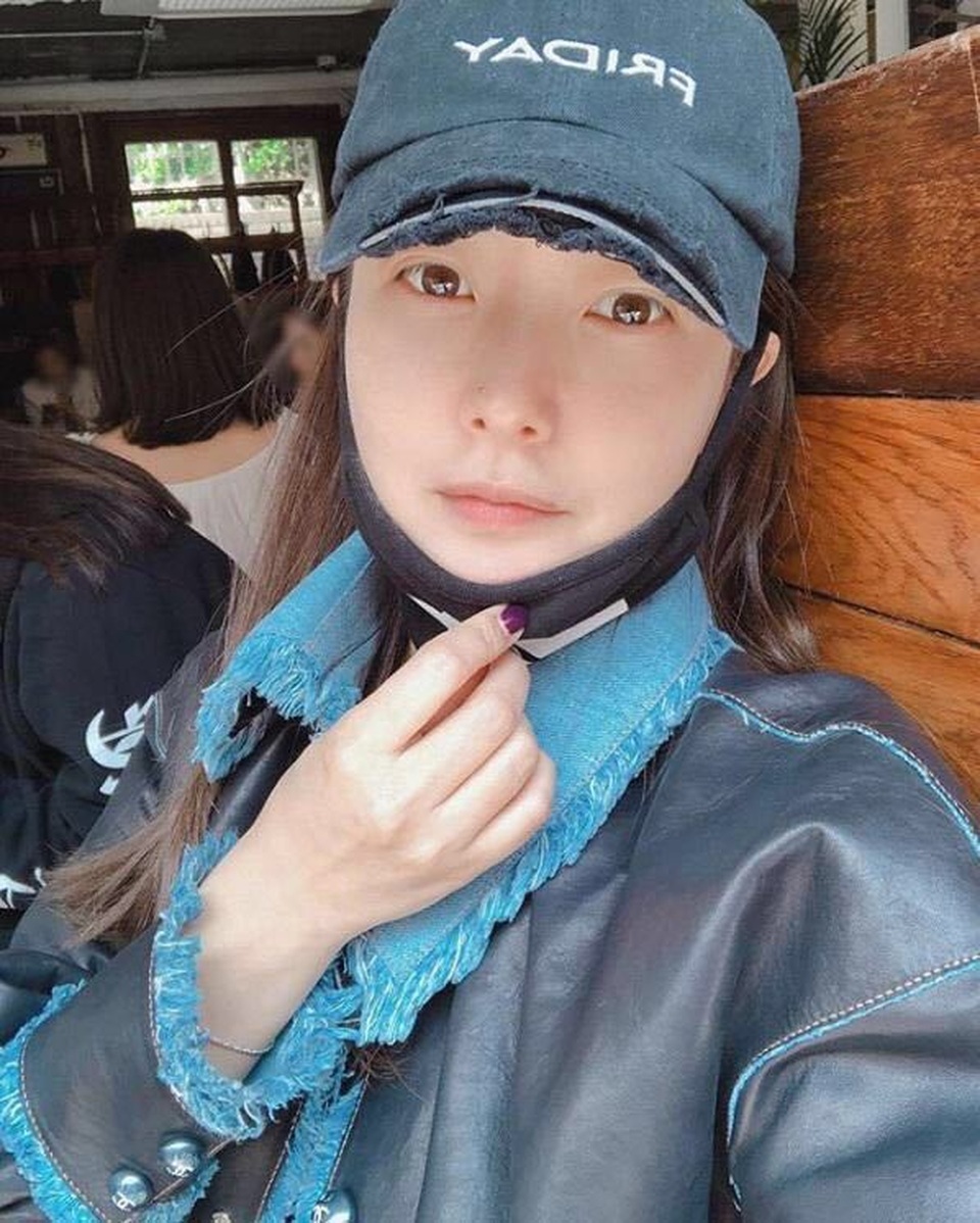 Gương mặt sưng phù của biểu tượng nhan sắc xứ Hàn Kim Hee Sun khiến fan hoang mang - 1 Gương mặt sưng phù của biểu tượng nhan sắc xứ Hàn Kim Hee Sun khiến fan hoang mang - 1