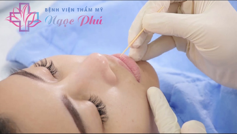 Phái đẹp ưa chuộng phun môi collagen tại Bệnh viện Thẩm mỹ Ngọc Phú - 2 Phái đẹp ưa chuộng phun môi collagen tại Bệnh viện Thẩm mỹ Ngọc Phú - 2