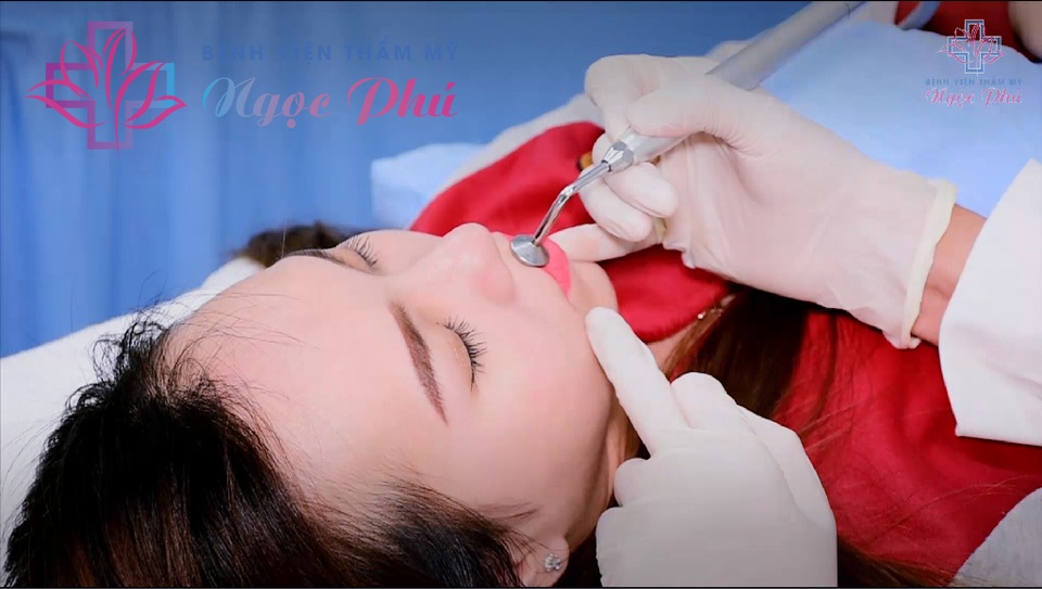 Phái đẹp ưa chuộng phun môi collagen tại Bệnh viện Thẩm mỹ Ngọc Phú - 3 Phái đẹp ưa chuộng phun môi collagen tại Bệnh viện Thẩm mỹ Ngọc Phú - 3