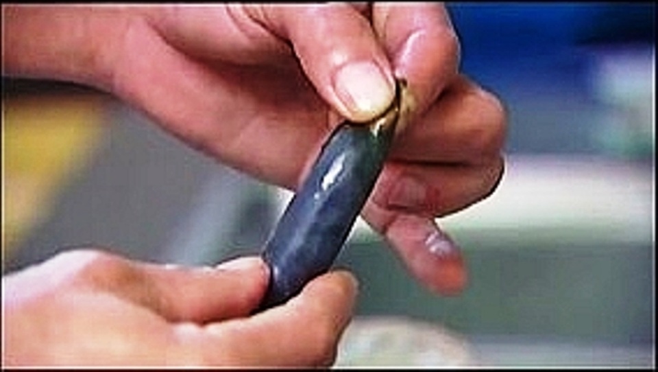 Nuốt mật cá trắm với rượu, người đàn ông ngộ độc phải nhập viện cấp cứu - 2 Nuốt mật cá trắm với rượu, người đàn ông ngộ độc phải nhập viện cấp cứu - 2