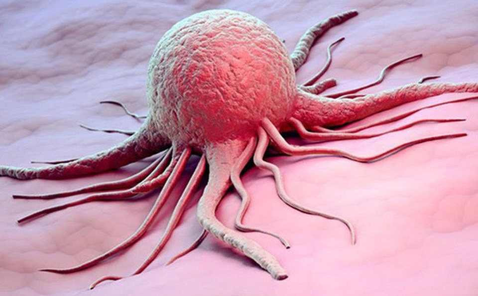 Bí quyết chống ung thư - sống lành mạnh thôi chưa đủ - 1 Bí quyết chống ung thư - sống lành mạnh thôi chưa đủ - 1